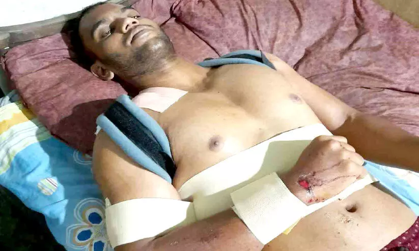 കാട്ടുപന്നി കുറുകെ ചാടി ബൈക്ക് യാത്രികന് പരിക്ക്