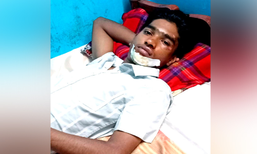 കയറുംമുമ്പ്​ വാതിലടച്ച്​ മുന്നോട്ടെടുത്തു; സ്വകാര്യ ബസിൽനിന്ന്​ വീണ്​ വിദ്യാർഥിക്ക്​ പരിക്ക്​