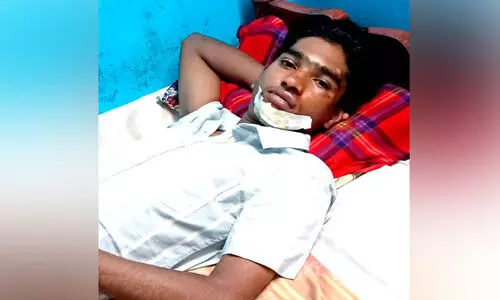 കയറുംമുമ്പ്​ വാതിലടച്ച്​ മുന്നോട്ടെടുത്തു; സ്വകാര്യ ബസിൽനിന്ന്​ വീണ്​ വിദ്യാർഥിക്ക്​ പരിക്ക്​