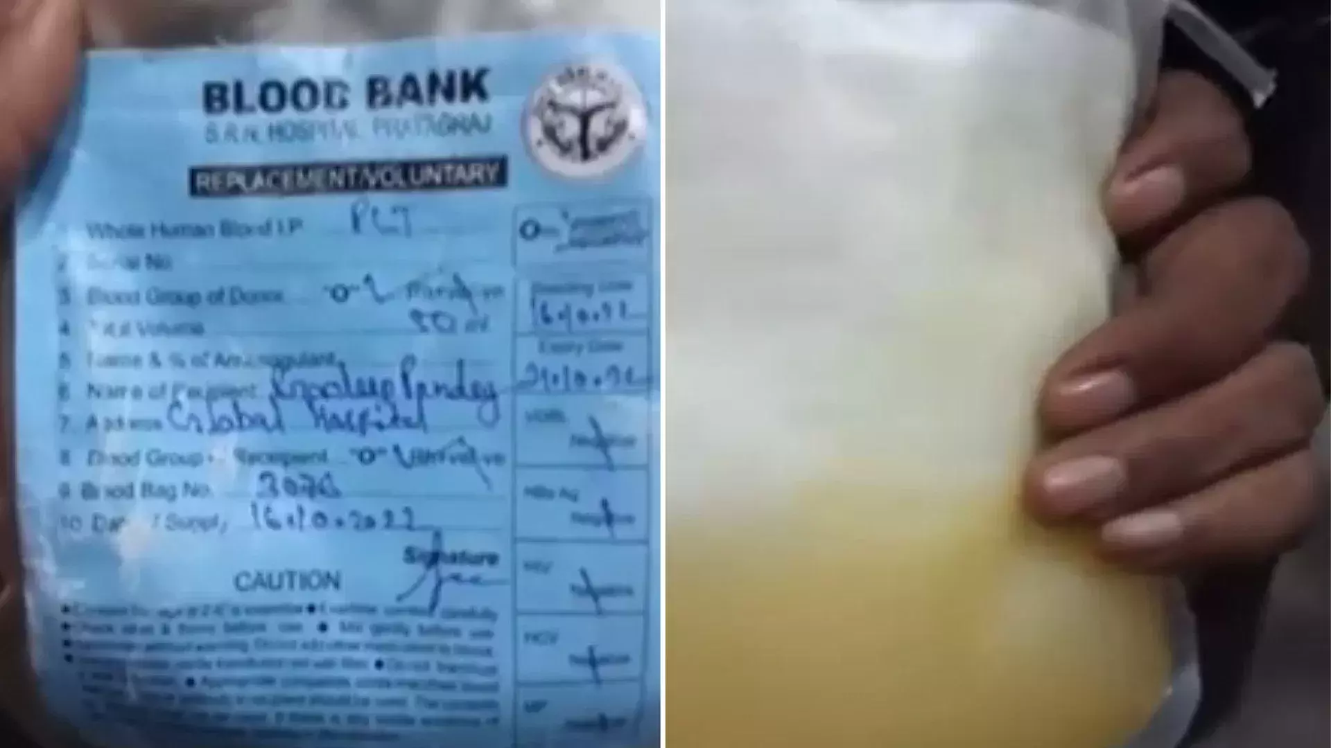 യു.പിയിൽ പ്ലാസ്മക്ക് പകരം ​മുസംബി ജ്യൂസ് നൽകിയ രോഗി മരിച്ചു; അന്വേഷണത്തിന് ഉത്തരവിട്ട് സർക്കാർ