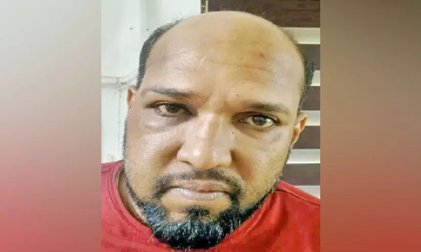 വഴിയാത്രക്കാരനെ ഇടിച്ചിട്ട ബൈക്ക് യാത്രികനിൽനിന്ന് മയക്കുമരുന്ന് പിടികൂടി വഴിയാത്രക്കാരനെ ഇടിച്ചിട്ട ബൈക്ക് യാത്രികനിൽനിന്ന് മയക്കുമരുന്ന് പിടികൂടി