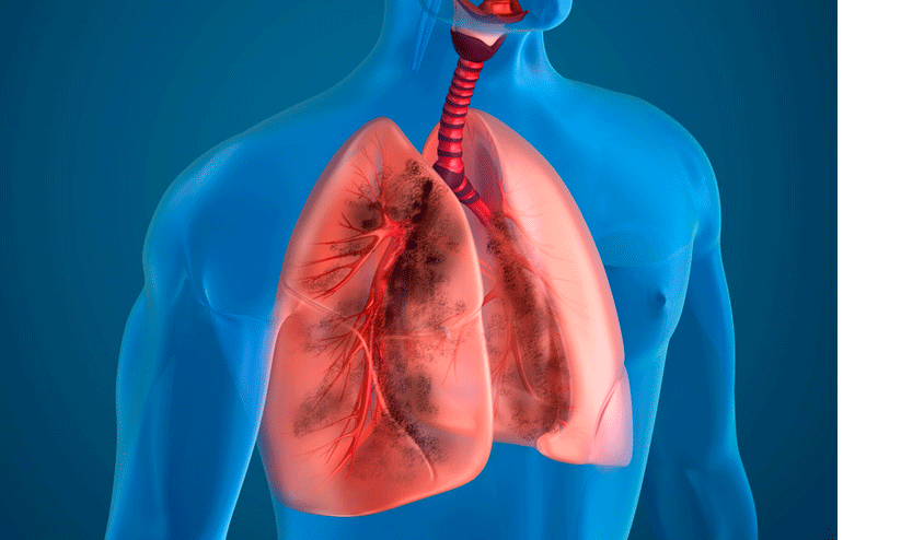 ശ്വാസകോശം സ്പോഞ്ചു പോലെയാണ്; എങ്ങനെ ശ്വാസകോശത്തെ സംരക്ഷിക്കാം