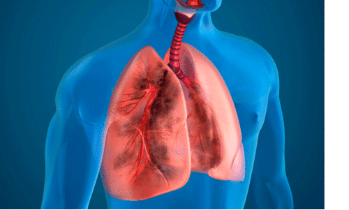 ശ്വാസകോശം സ്പോഞ്ചു പോലെയാണ്; എങ്ങനെ ശ്വാസകോശത്തെ സംരക്ഷിക്കാം