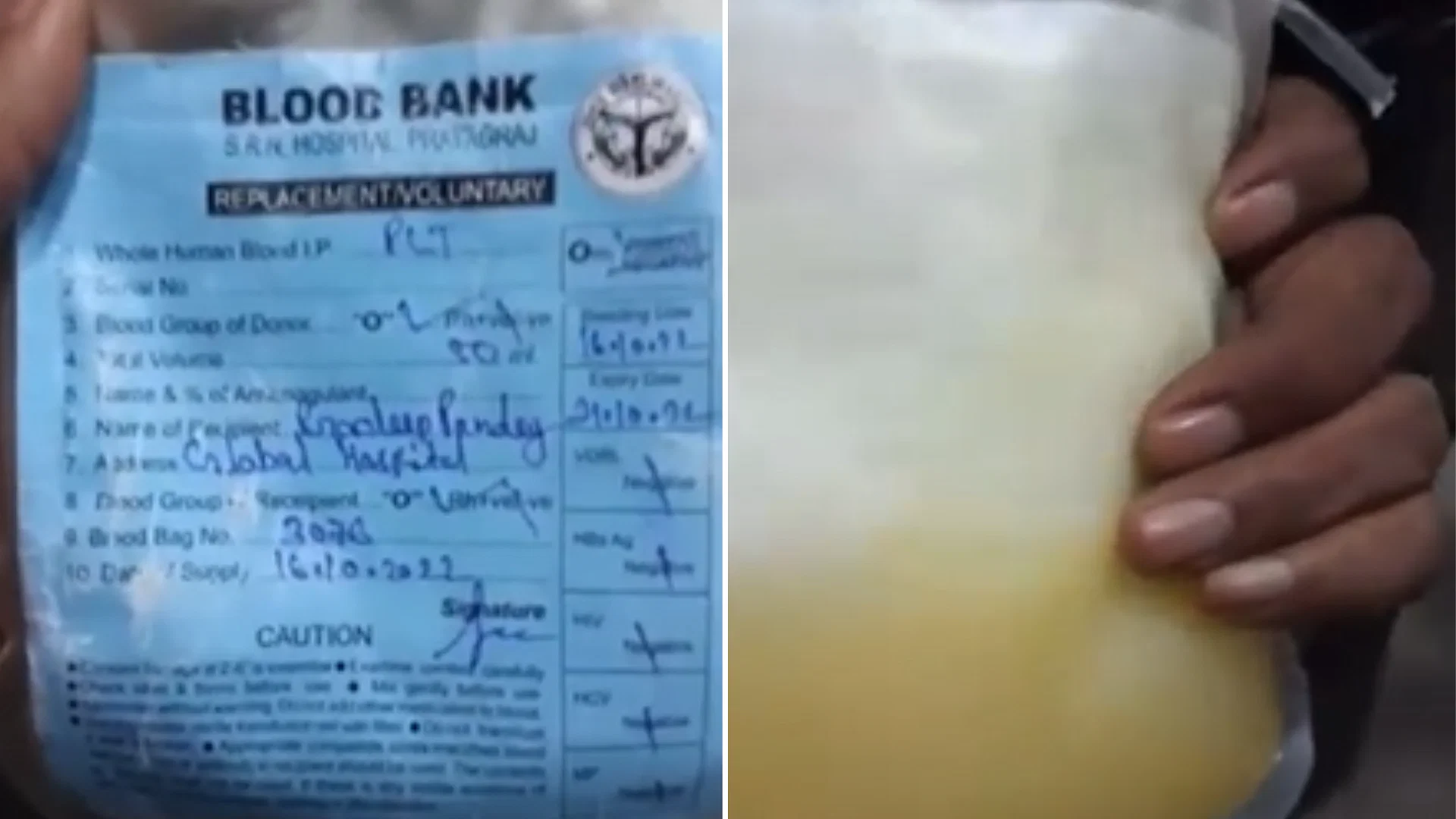 യു.പിയിൽ പ്ലാസ്മക്ക് പകരം ​മുസംബി ജ്യൂസ് നൽകിയ രോഗി മരിച്ചു; അന്വേഷണത്തിന് ഉത്തരവിട്ട് സർക്കാർ