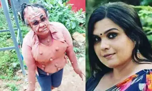 വിഷമഴയുടെ ഇരകളു​ടെ ജീവിതം ആവിഷ്കരിച്ച് കാവ്യ