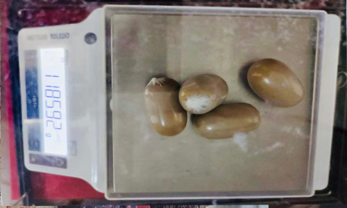 നടത്തത്തിൽ സംശയം: 1.18 കിലോ സ്വർണം മലദ്വാരത്തിൽ ഒളിച്ചുകടത്തിയ യുവാവ് അറസ്റ്റിൽ