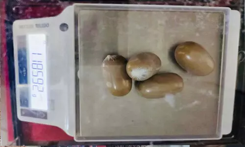 നടത്തത്തിൽ സംശയം: 1.18 കിലോ സ്വർണം മലദ്വാരത്തിൽ ഒളിച്ചുകടത്തിയ യുവാവ് അറസ്റ്റിൽ