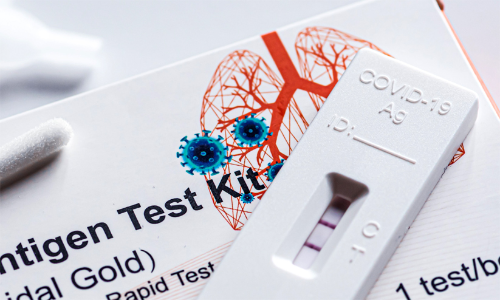 covid test- qatar world cup