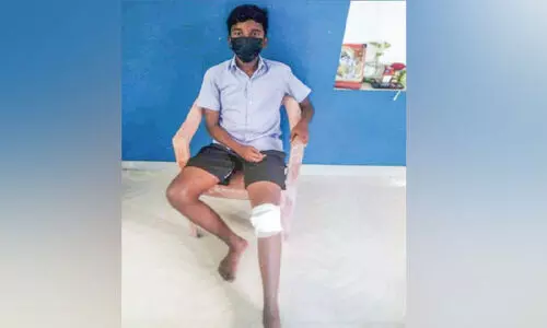 സ്വകാര്യ ബസുകളുടെ മത്സരയോട്ടം; ബസിൽനിന്ന് വീണ് വിദ്യാർഥിക്ക് പരിക്ക് സ്വകാര്യ ബസുകളുടെ മത്സരയോട്ടം; ബസിൽനിന്ന് വീണ് വിദ്യാർഥിക്ക് പരിക്ക്