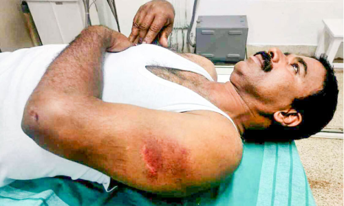 എക്സൈസ് ഉദ്യോഗസ്ഥനെ വാഹനമിടിച്ച് അപായപ്പെടുത്താൻ ശ്രമം