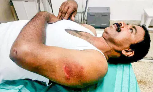 എക്സൈസ് ഉദ്യോഗസ്ഥനെ വാഹനമിടിച്ച് അപായപ്പെടുത്താൻ ശ്രമം