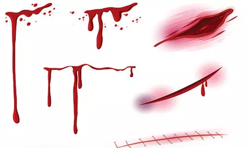 വയോധികയെ കഴുത്തിന് മുറിവേറ്റ നിലയിൽ കണ്ടെത്തി