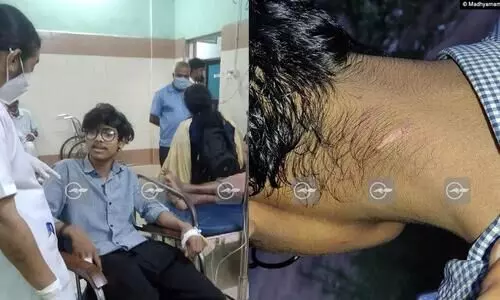 വീണ്ടും റാഗിങ്: കാഴ്ചക്കുറവുള്ള വിദ്യാർഥിയോട് കണ്ണട മാറ്റാനാവശ്യപ്പെട്ട് ആക്രമണം