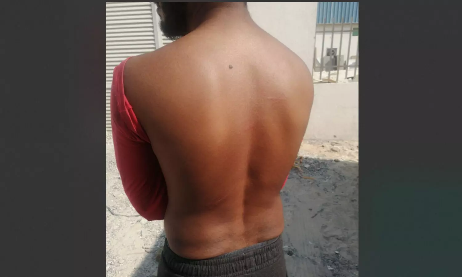 ശമ്പള കുടിശ്ശിക ചോദിച്ചതിന്​ അജ്​മാനിൽ മലയാളി യുവാക്കൾക്ക്​ മർദനം