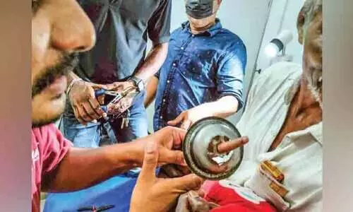 വാഷ് ബേസിനിൽ കുടുങ്ങിയ കുട്ടിയുടെ വിരൽ ഇ.ആർ.എഫ് പുറത്തെടുത്തു