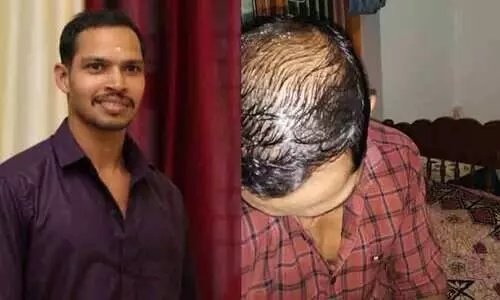 ഡോക്ടറുടെ മരുന്ന് കഴിച്ചപ്പോൾ മുടിയും മീശയും പുരികവും കൊഴിഞ്ഞു; സഹിക്കാനാവുന്നില്ല; പിന്നാലെ ആത്മഹത്യ