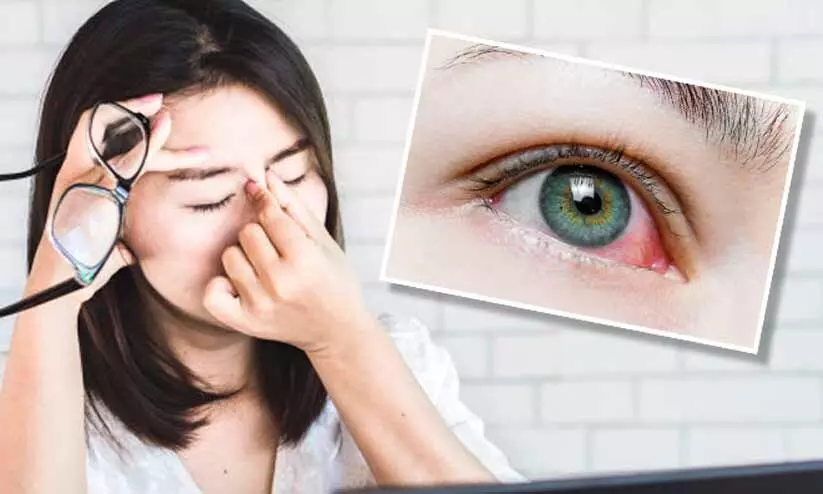 നോക്കണ്ട, ചെങ്കണ്ണാ; കാലാവസ്ഥ മാറ്റമാണ് ചെങ്കണ്ണ് ബാധക്ക് കാരണം നോക്കണ്ട, ചെങ്കണ്ണാ; കാലാവസ്ഥ മാറ്റമാണ് ചെങ്കണ്ണ് ബാധക്ക് കാരണം