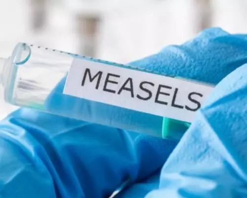 Measles