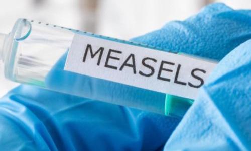 Measles
