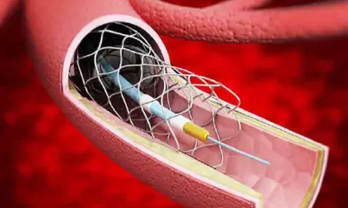 അ​വ​ശ്യ മ​രു​ന്നു​ക​ളു​ടെ പ​ട്ടി​ക​യി​ൽ സ്റ്റെ​ന്റും