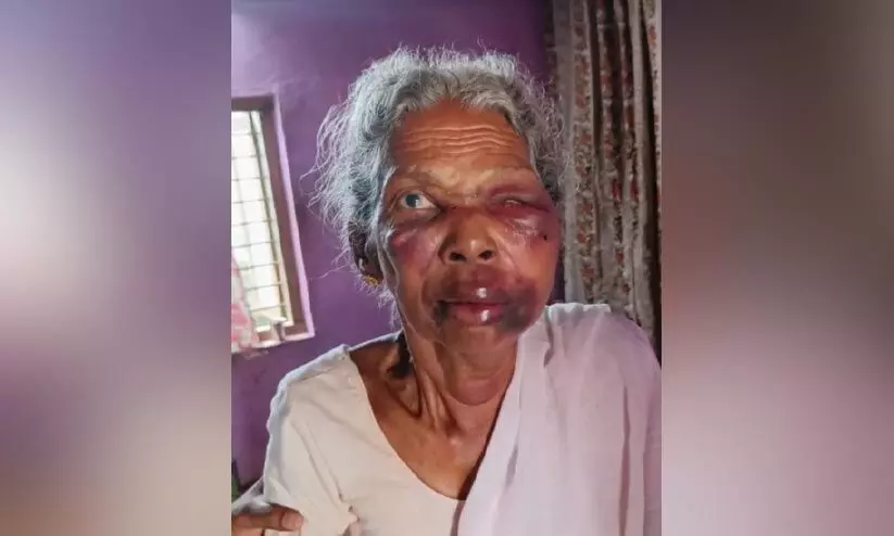 വെള്ളം ചോദിച്ചെത്തിയ യുവാവ് വൃദ്ധയെ ആക്രമിച്ച് മാല പൊട്ടിച്ചു കടന്നു വെള്ളം ചോദിച്ചെത്തിയ യുവാവ് വൃദ്ധയെ ആക്രമിച്ച് മാല പൊട്ടിച്ചു കടന്നു