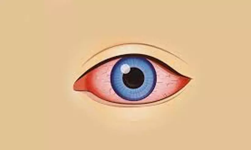 eye infection eye infection