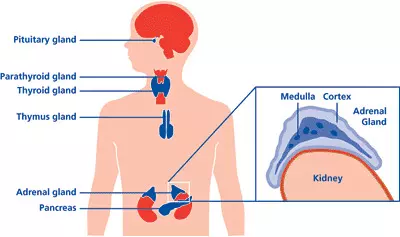 C A H disease C A H disease