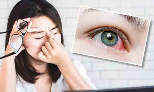 ജി​ല്ല​യു​ടെ വി​വി​ധ മേ​ഖ​ല​ക​ളി​ൽ ചെ​ങ്ക​ണ്ണ് പ​ട​രു​ന്നു