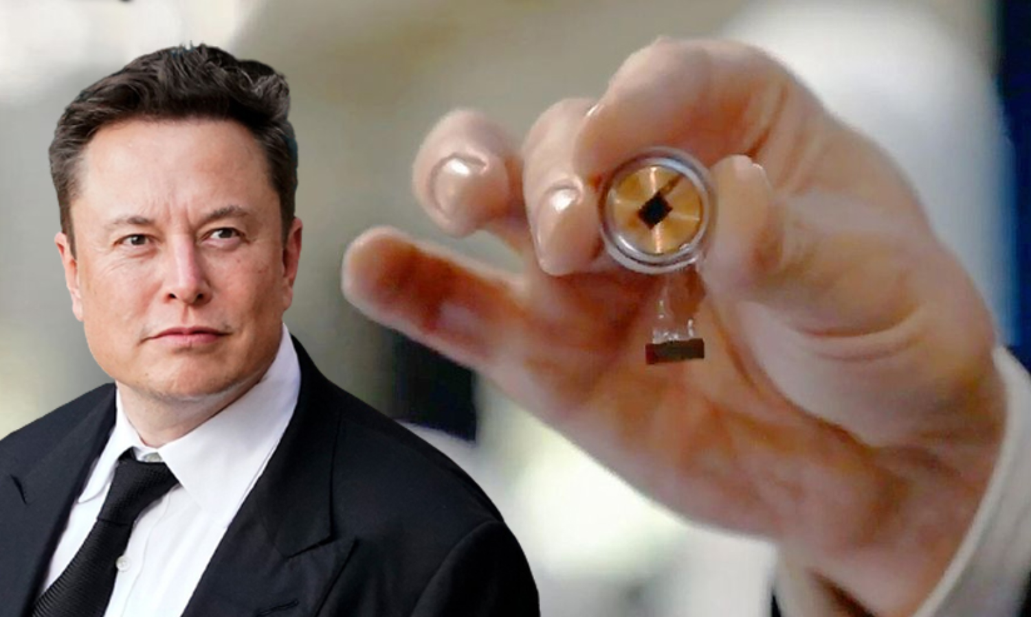 ചിപ്പ് റെഡി; മനുഷ്യന്റെ തലച്ചോറിൽ പരീക്ഷണത്തിനൊരുങ്ങി ഇലോൺ മസ്കിന്റെ ന്യൂറാലിങ്ക്