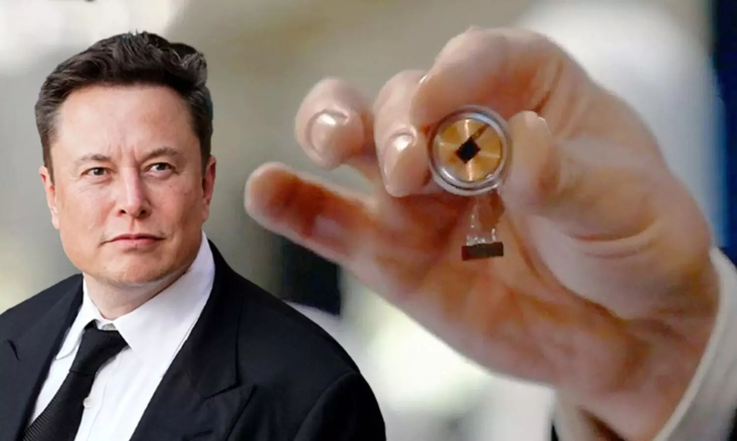 ചിപ്പ് റെഡി; മനുഷ്യന്റെ തലച്ചോറിൽ പരീക്ഷണത്തിനൊരുങ്ങി ഇലോൺ മസ്കിന്റെ ന്യൂറാലിങ്ക്
