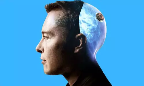 ന്യൂറലിങ്കിന്റെ ചിപ്പ് ഇലോൺ മസ്കിന്റെ തലച്ചോറിൽ ഘടിപ്പിക്കുമോ..? വെളിപ്പെടുത്തലുമായി ലോകകോടീശ്വരൻ