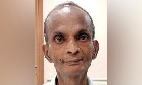 കരള്‍മാറ്റ ശസ്ത്രക്രിയക്കായി കൊടിയത്തൂർ സ്വദേശി സുമനസ്സുകളുടെ സഹായംതേടുന്നു