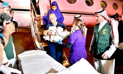 തമ്മിലകലാൻ സാധ്യത തേടി​ നൈജീരിയൻ സയാമീസുകൾ റിയാദിൽ