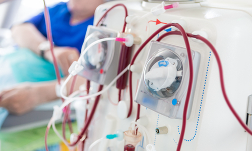 ഇൻഷുറൻസ് പരിരക്ഷയില്ല; ഡയാലിസിസ് രോഗികൾ ദുരിതത്തിൽ