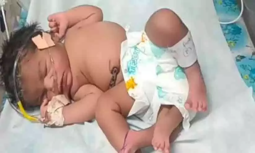 baby girl with 4 legs baby girl with 4 legs