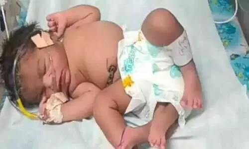 baby girl with 4 legs baby girl with 4 legs