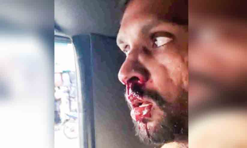 തിരൂരിൽ ഓട്ടോ ഡ്രൈവർക്ക് മർദനം; നഗരത്തിൽ   മണിക്കൂറുകളോളം സംഘർഷാവസ്ഥ