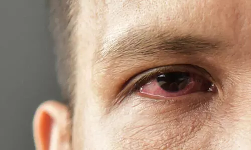 ചെങ്കണ്ണ് സ്വയംചികിത്സ അപകടം