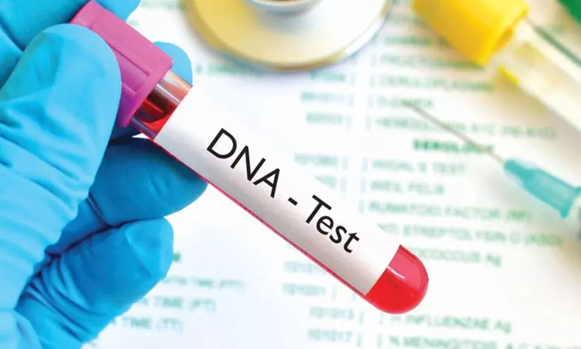 മകന്‍റെ പിതൃത്വത്തിൽ സംശയം; ഡി.എൻ.എ പരിശോധന നടത്തി കുടുംബപ്രശ്നം പരിഹരിച്ചു