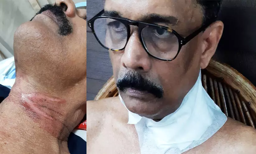 cable accident -sabu cable accident -sabu