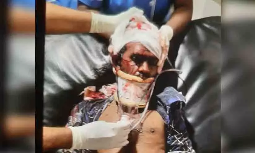 ട്രെയിനിൽനിന്ന് തെറിച്ചുവീണ് യുവാവിന് പരിക്ക് ട്രെയിനിൽനിന്ന് തെറിച്ചുവീണ് യുവാവിന് പരിക്ക്