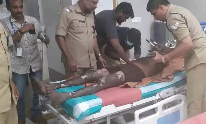 ശബരിമല വെടിപ്പുര അപകടം: വെടിവഴിപാട് നിർത്തി; പരിക്കേറ്റ ജയകുമാറിന്റെ നില ഗുരുതരം