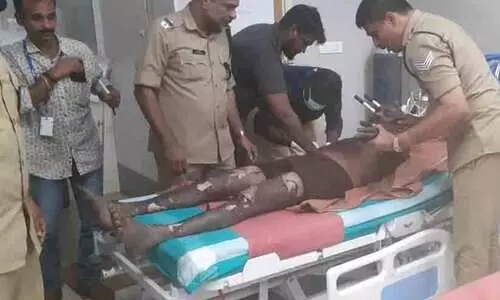 ശബരിമല വെടിപ്പുര അപകടം: വെടിവഴിപാട് നിർത്തി; പരിക്കേറ്റ ജയകുമാറിന്റെ നില ഗുരുതരം