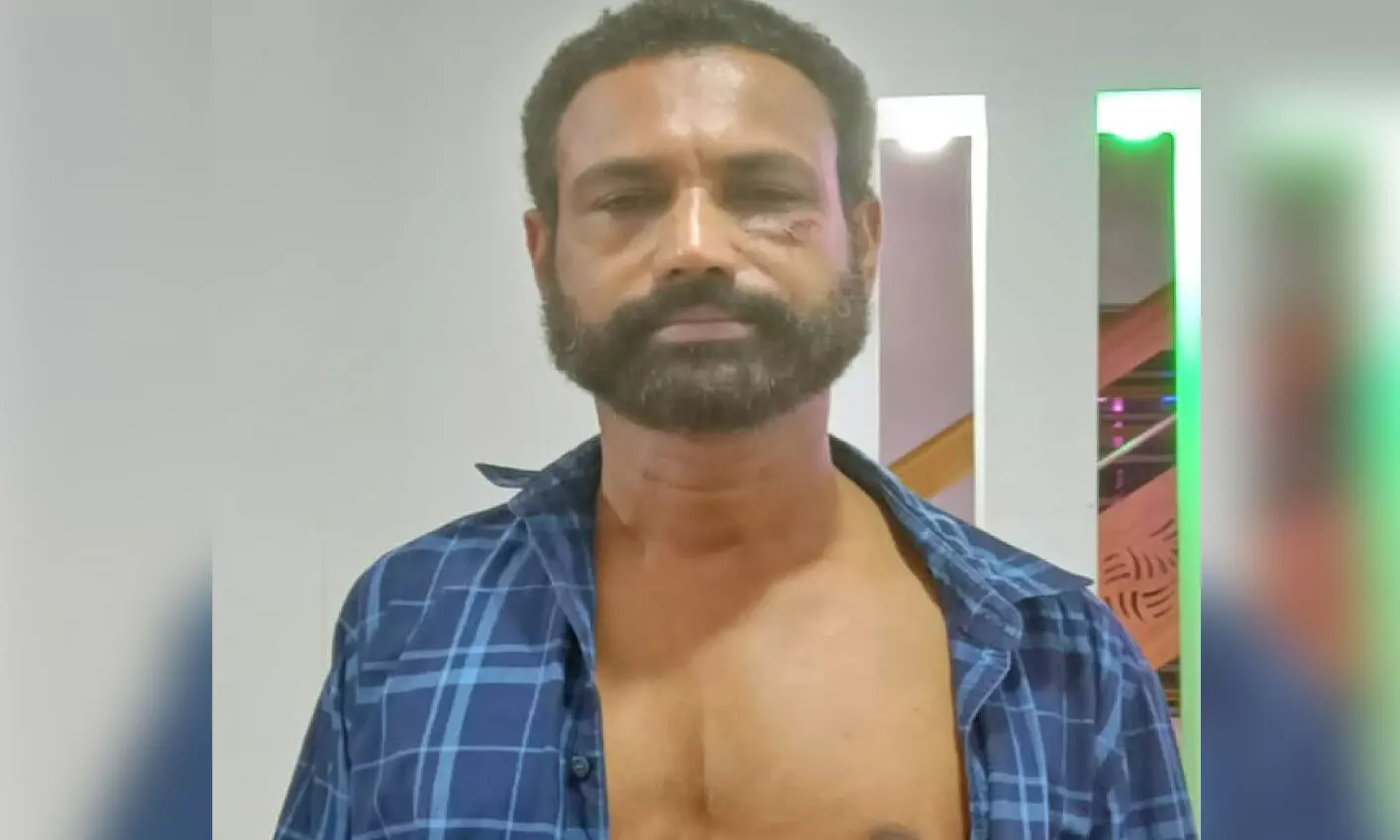 തെരുവുനായ് മുഖത്ത് ചാടിക്കടിച്ചിട്ടും പിടിവിട്ടില്ല; നാടിന്റെ രക്ഷകനായി ബാബു തെരുവുനായ് മുഖത്ത് ചാടിക്കടിച്ചിട്ടും പിടിവിട്ടില്ല; നാടിന്റെ രക്ഷകനായി ബാബു