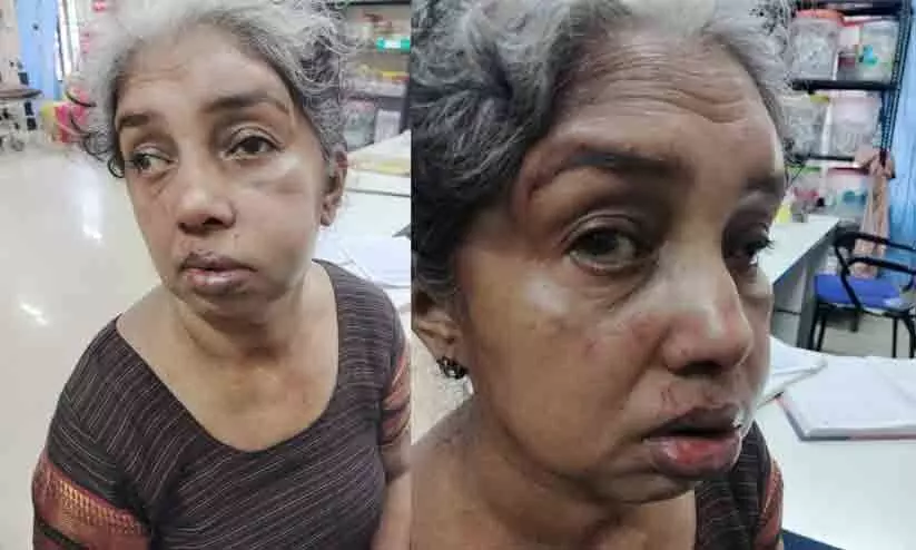 വീട്ടമ്മയെ അടിച്ചുവീഴ്ത്തി 10 പവൻ കവർന്നു