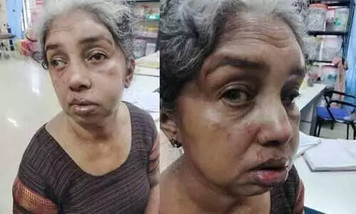 വീട്ടമ്മയെ അടിച്ചുവീഴ്ത്തി 10 പവൻ കവർന്നു