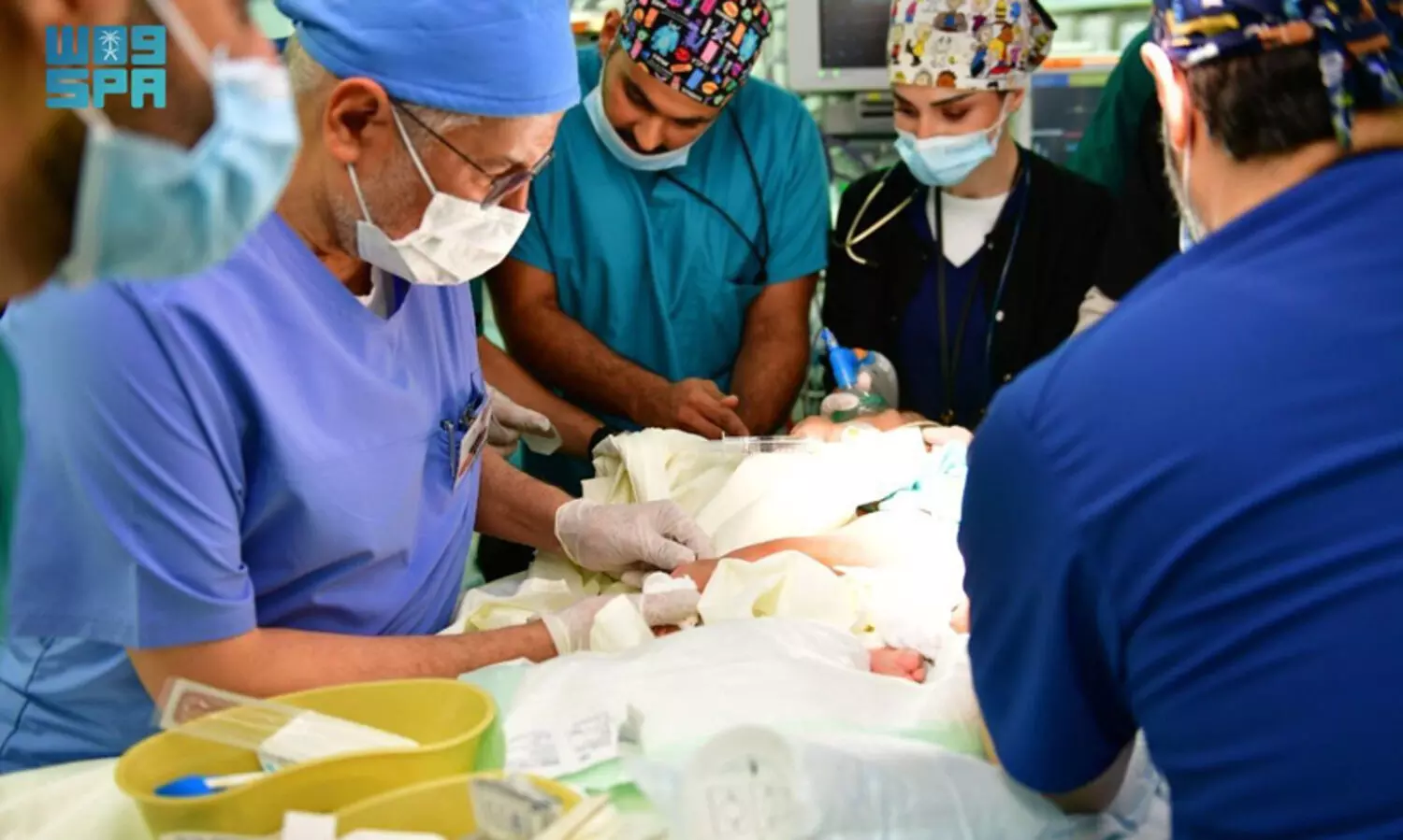 സൗദി സയാമീസ് ഇരട്ടകളെ വേർപ്പെടുത്തി