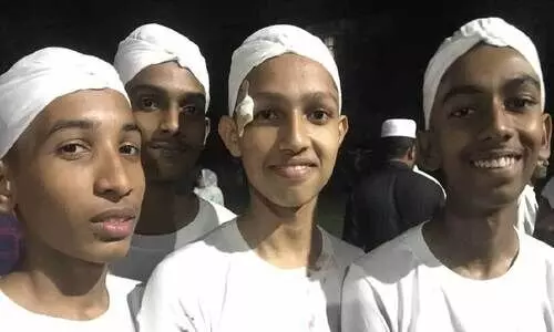 കോൽക്കളിക്കിടെ തല പൊട്ടിയിട്ടും കളി തുടർന്നു; ടീമിന് എ ഗ്രേഡ്