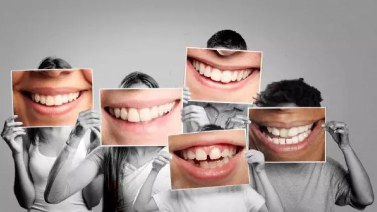 ഉന്തിയ പല്ലുകൾ: കാരണവും പരിഹാരങ്ങളും ഉന്തിയ പല്ലുകൾ: കാരണവും പരിഹാരങ്ങളും