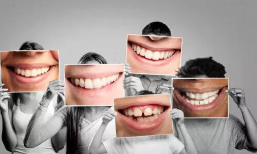 ഉന്തിയ പല്ലുകൾ: കാരണവും പരിഹാരങ്ങളും ഉന്തിയ പല്ലുകൾ: കാരണവും പരിഹാരങ്ങളും